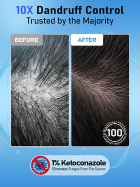 Gembooxt shampoo texture on hand demonstrating gentle lather for scalp care