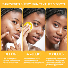 GEMSKIN turmeric and kojic acid ingredient display signaling brightening