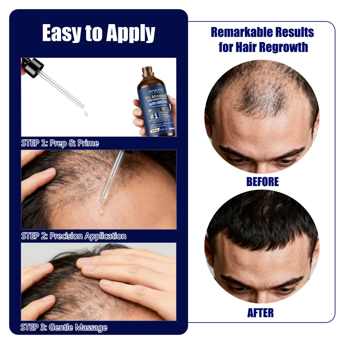 Gemächlich Zu Hause scalp application demo illustrating focused crown treatment