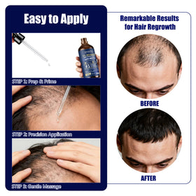 Gemächlich Zu Hause scalp application demo illustrating focused crown treatment