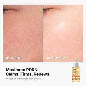 Genabelle ampoule open dropper detail showing precision dosing and easy use benefit