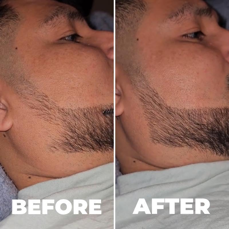 Generic 2 Tip UltraFine Pen with packaging showing size comparison and travel-ready benefit