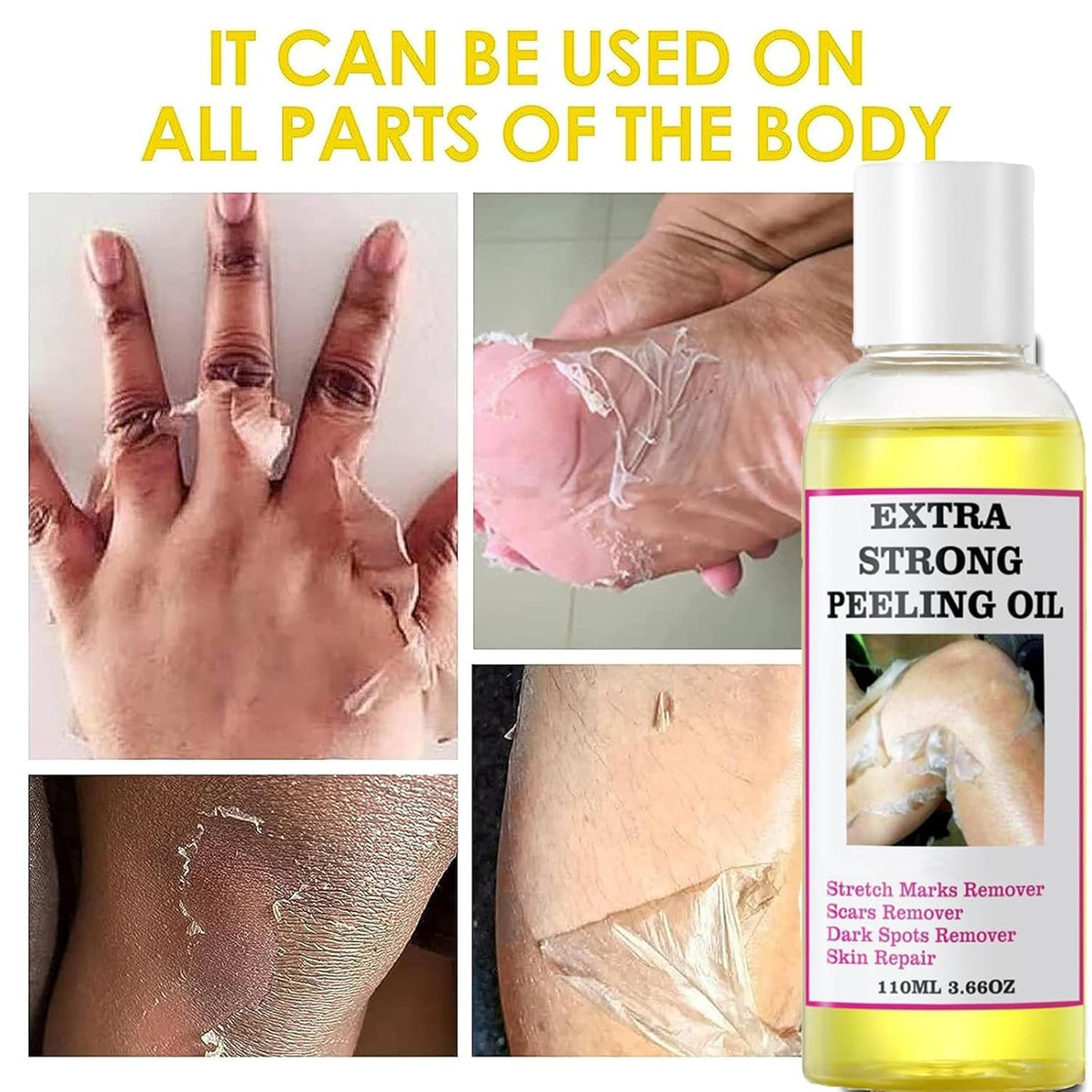 Generic after-peel smooth skin on forearm illustrating softer, renewed appearance