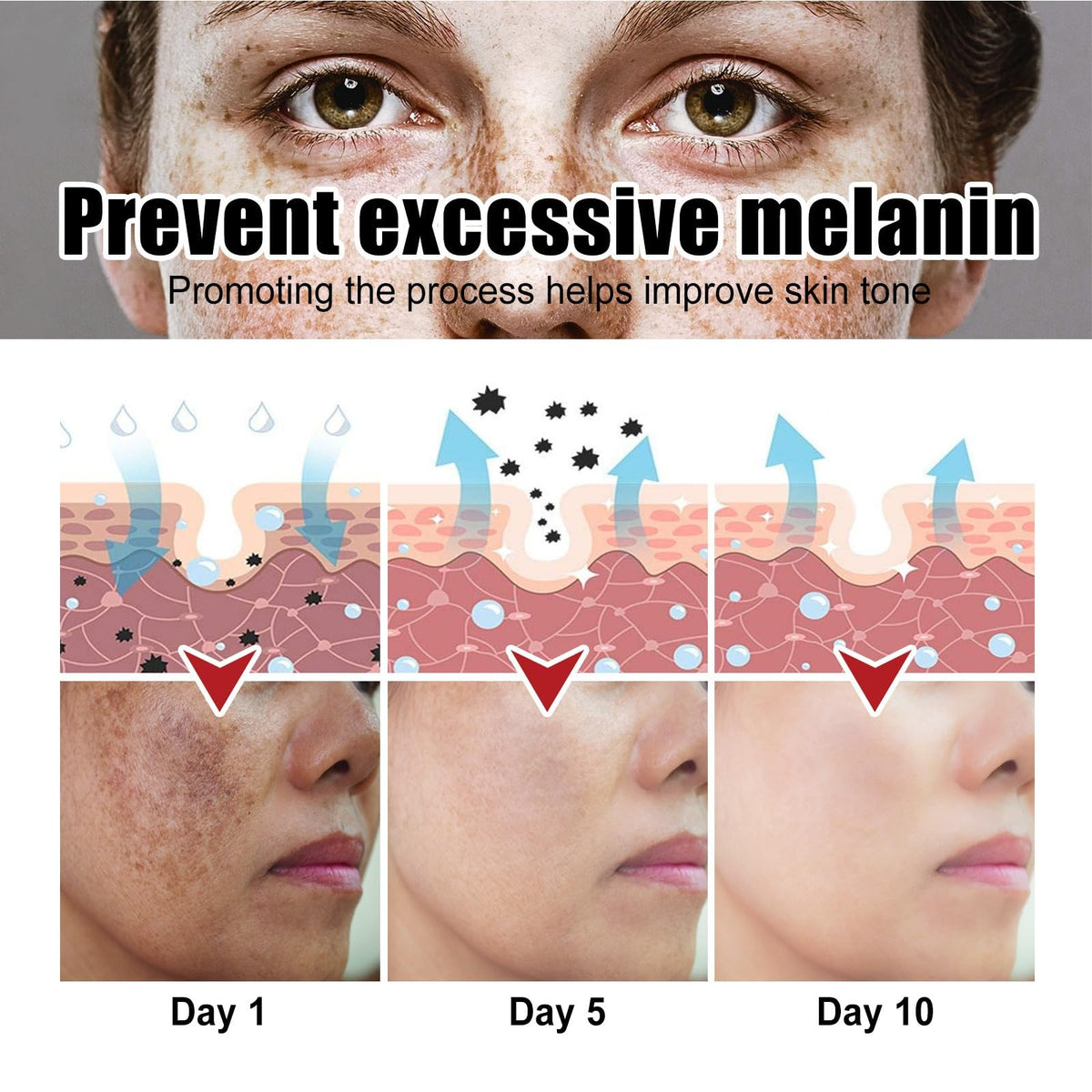 Generic before and after comparison showing reduced dark spots and improved evenness