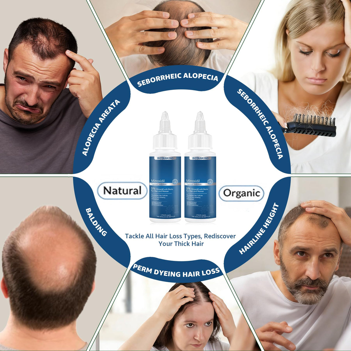 Generic close-up dropper applying minoxidil serum for precise targeted treatment