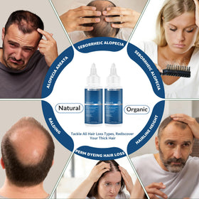 Generic close-up dropper applying minoxidil serum for precise targeted treatment