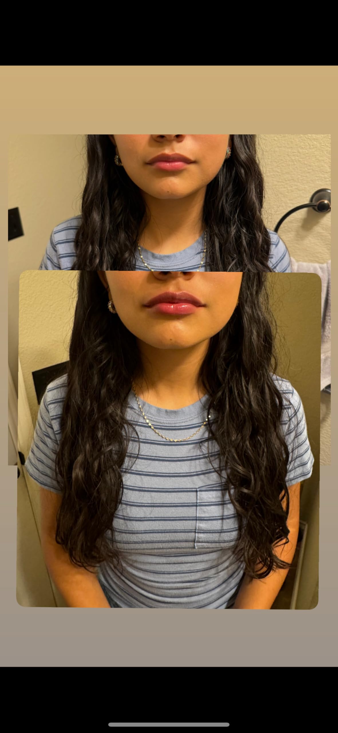 Generic before and after lips comparison showing fuller plumped result benefit