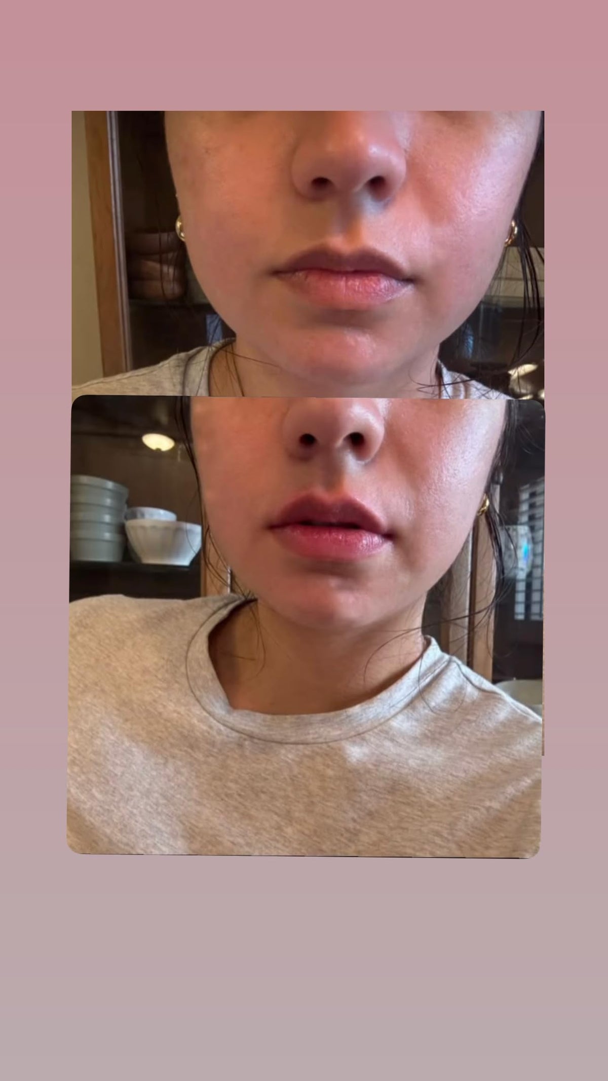 Generic gloss layered over lipstick showing enhanced shine and volume benefit