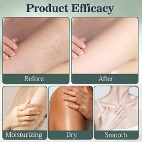 Generic brand applied under bust to protect skin folds and reduce irritation