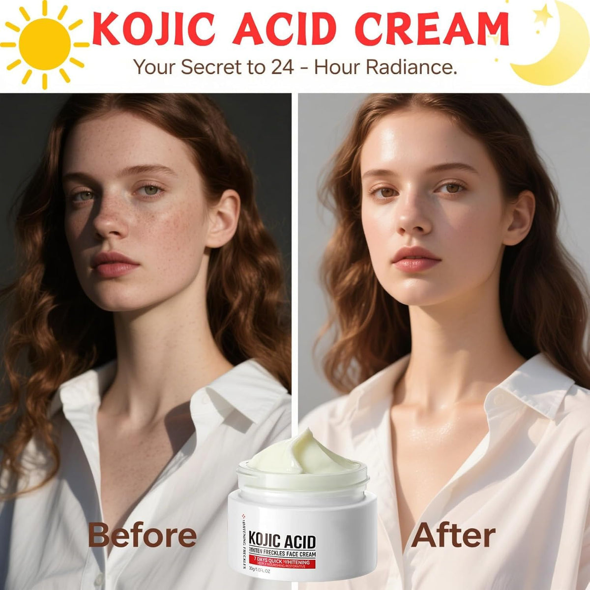 Generic kojic acid cream application on face demonstrating targeted dark spot care