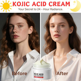 Generic kojic acid cream application on face demonstrating targeted dark spot care