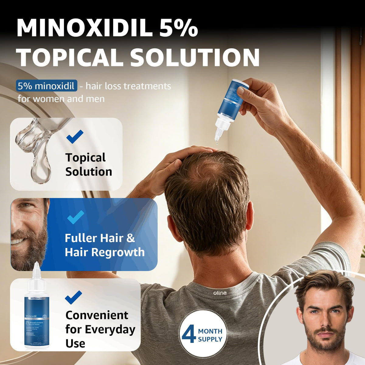 Generic label and ingredient list detail emphasizing 5% minoxidil and biotin