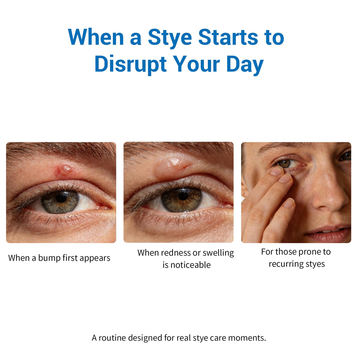 Generic brand steam patch on closed eyes displaying calming evening use
