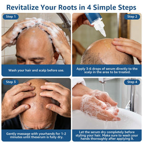 Generic scalp application demo illustrating targeted use for thinning patches