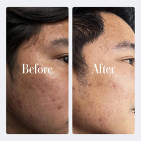 Geologie retinol before and after illustrative comparison showing smoother appearance