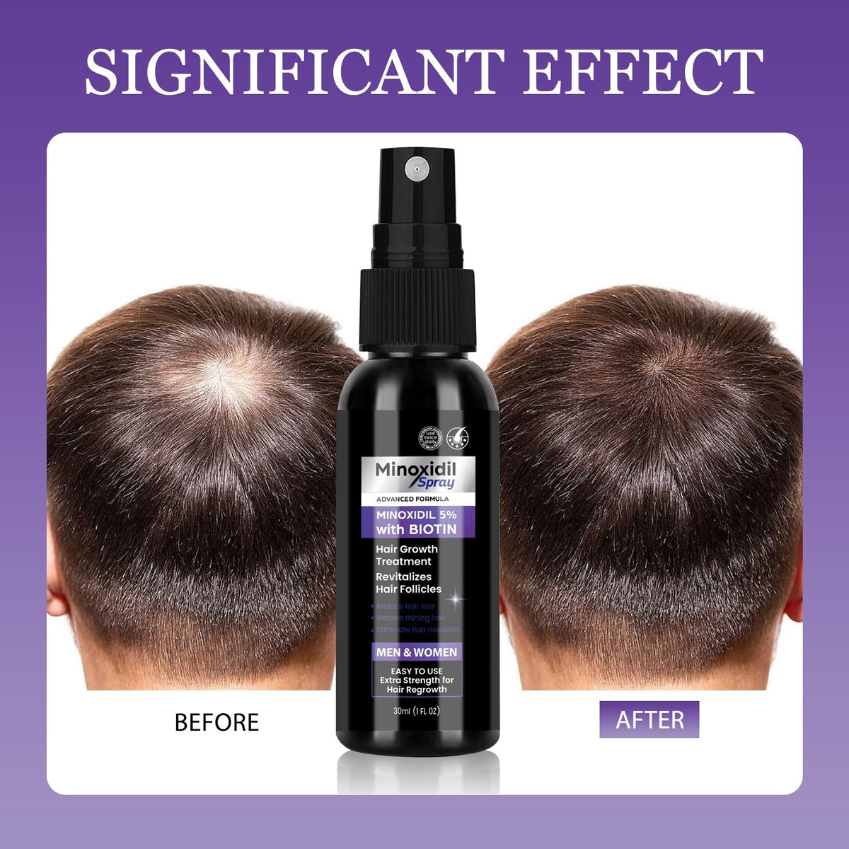 Geynaw two-pack on bathroom shelf in daily routine setting for consistent treatment benefit