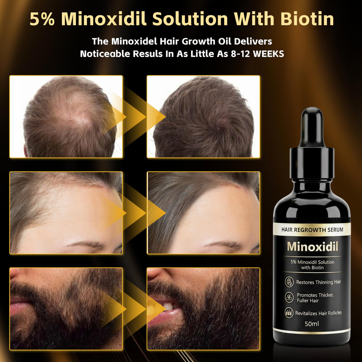 GHKLNY dropper applying minoxidil essence to scalp for targeted delivery