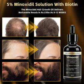 GHKLNY dropper applying minoxidil essence to scalp for targeted delivery