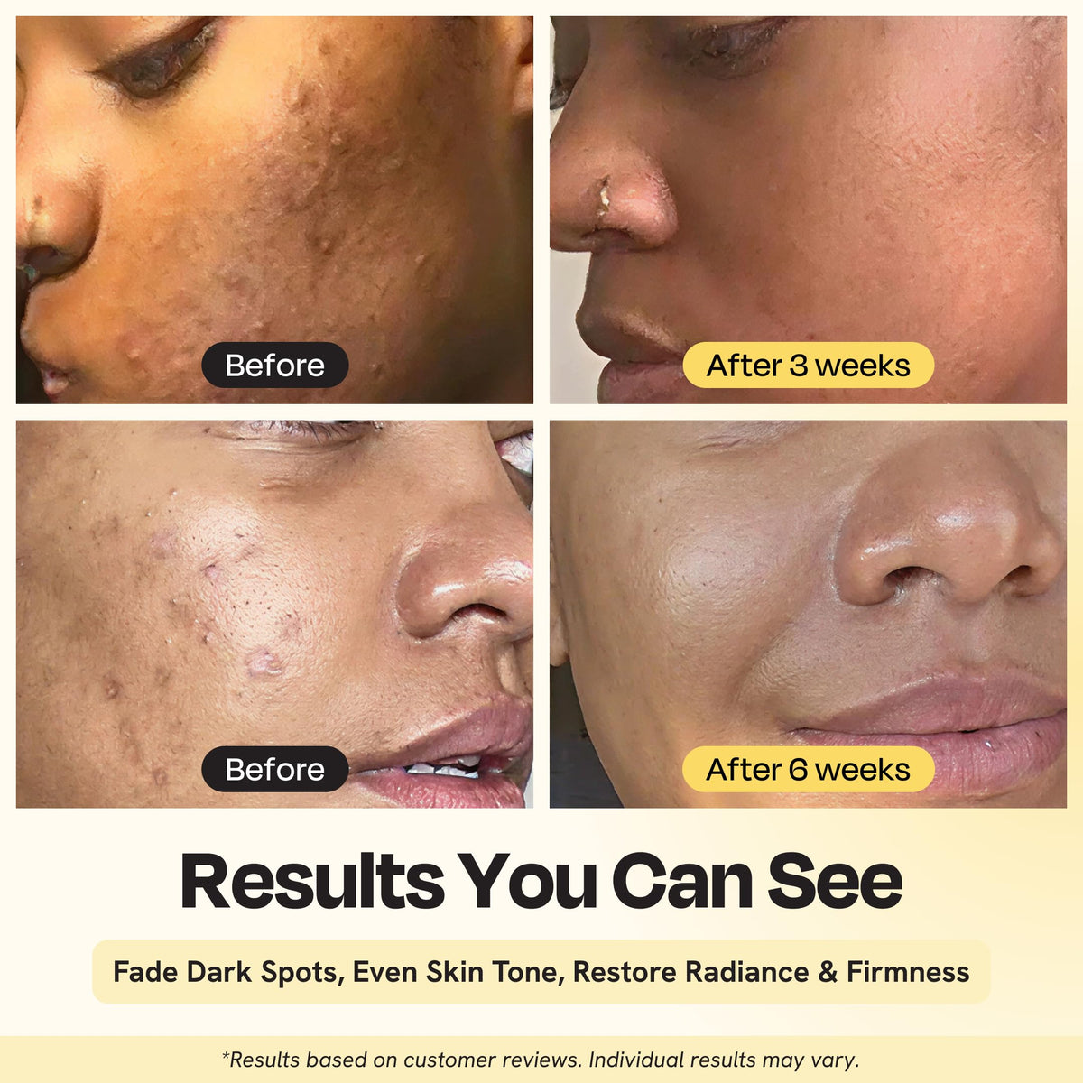 Gleamin dropper dispensing serum texture for fast absorption benefit