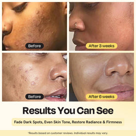 Gleamin dropper dispensing serum texture for fast absorption benefit