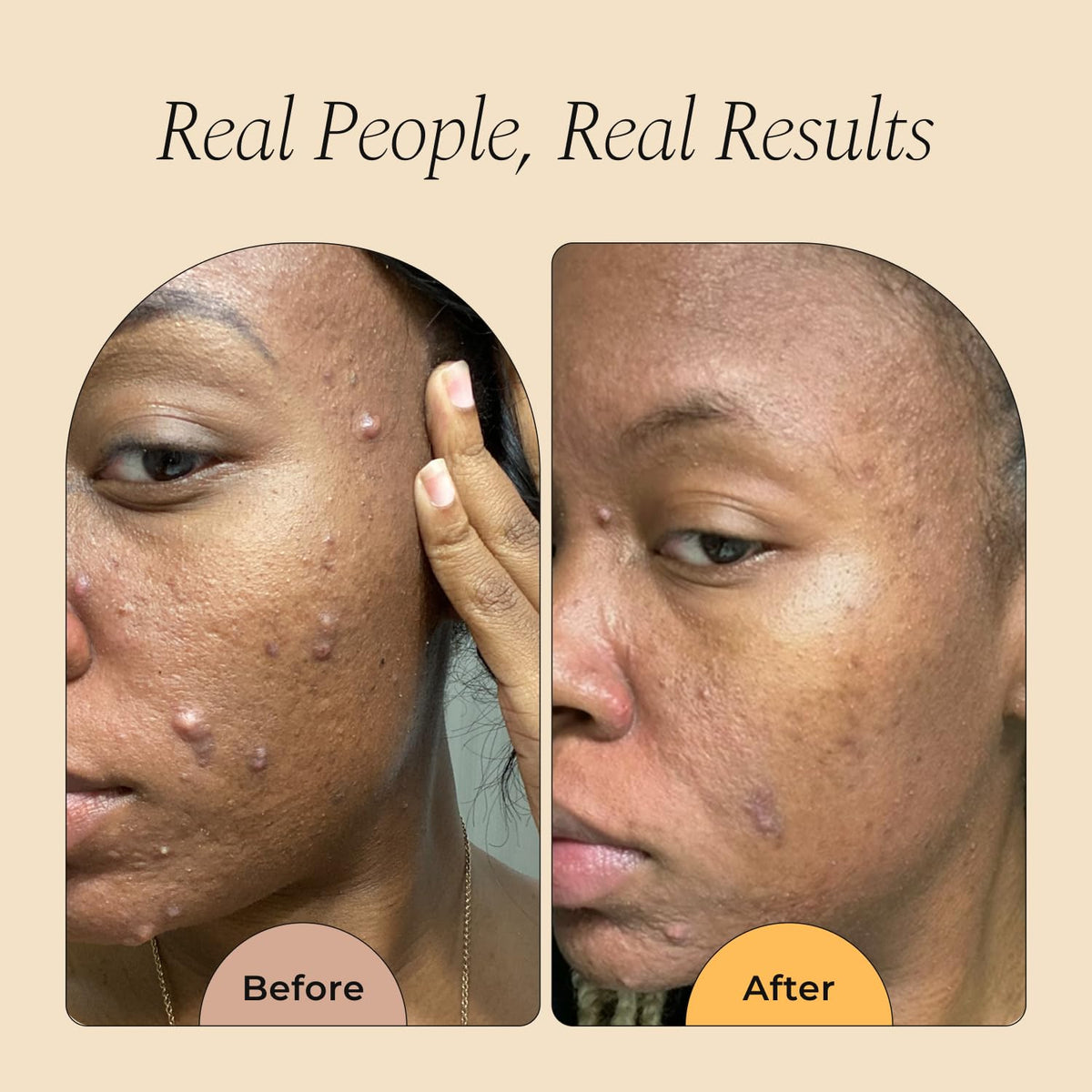 Glo Melanin airy foam texture closeup for effective, non-stripping cleansing