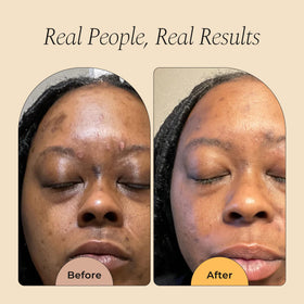 Glo Melanin ingredient list label showing active brighteners and benefits