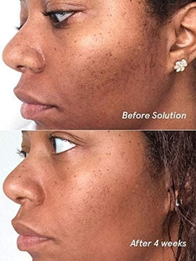 Glossier Solution texture pouring from bottle demonstrating lightweight liquid and quick-absorbing benefit