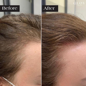 Glov Beauty ampoule close-up highlighting peptide and hyaluronic formula
