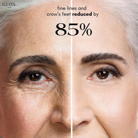 Glov Beauty patch applied under eye showing reduced puffiness look