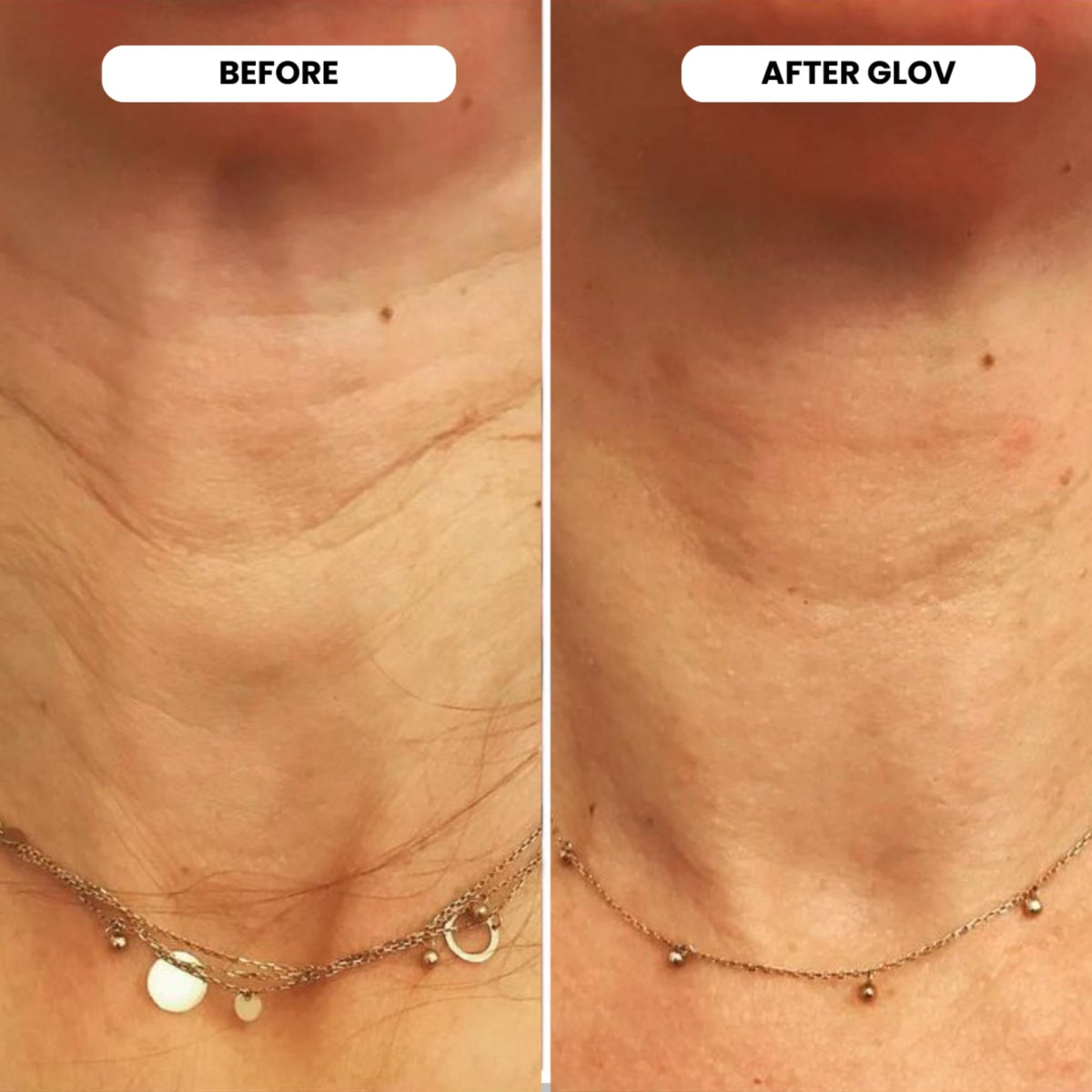 Glov Beauty applicator in hand to demonstrate size and comfortable grip