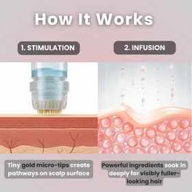 Glov Beauty derma stamp in use on scalp demonstrating controlled application