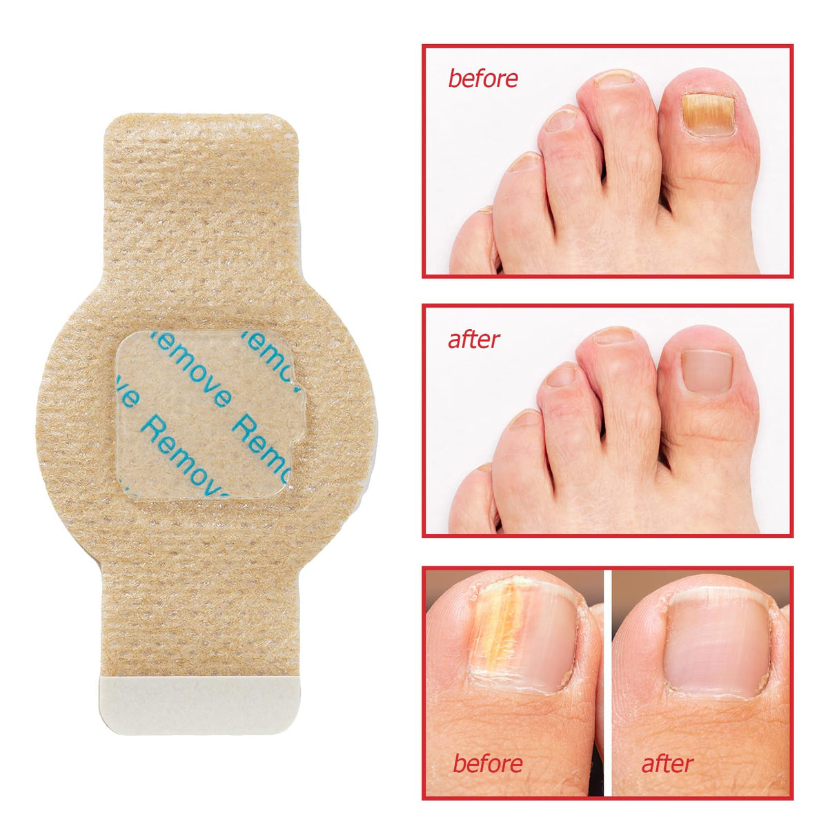 Glovoro patch being applied on fingernail for quick application benefit