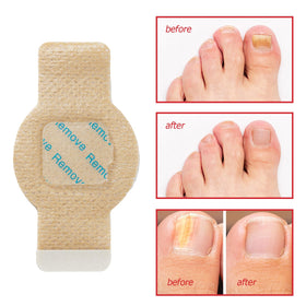 Glovoro patch being applied on fingernail for quick application benefit
