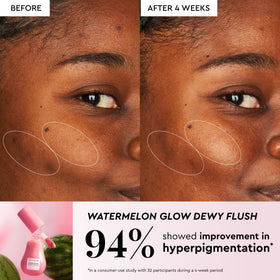 Glow Recipe set staged in a travel pouch to show portability and on-the-go touch-ups