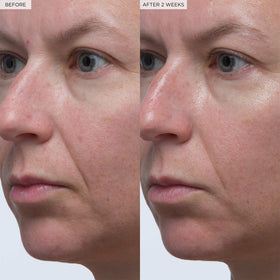 Glow Recipe before and after skin sample demonstrating improved plumpness and texture