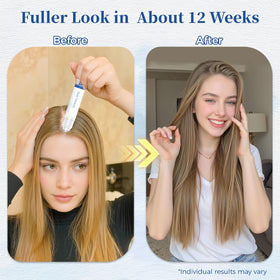 Gluvelessia roll-on application on scalp demonstrating targeted coverage benefit