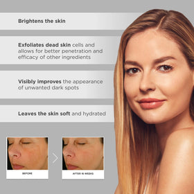 Glytone being applied to décolleté, demonstrates brightening use benefits