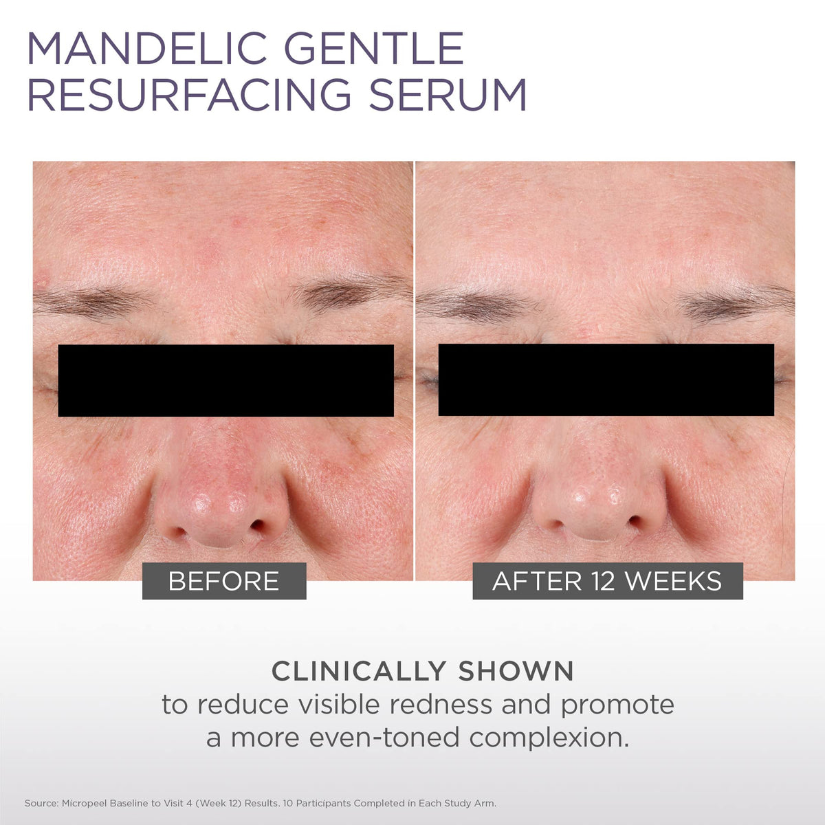 Glytone serum applied as part of a nighttime routine, demonstrates gentle layering