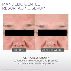 Glytone serum applied as part of a nighttime routine, demonstrates gentle layering