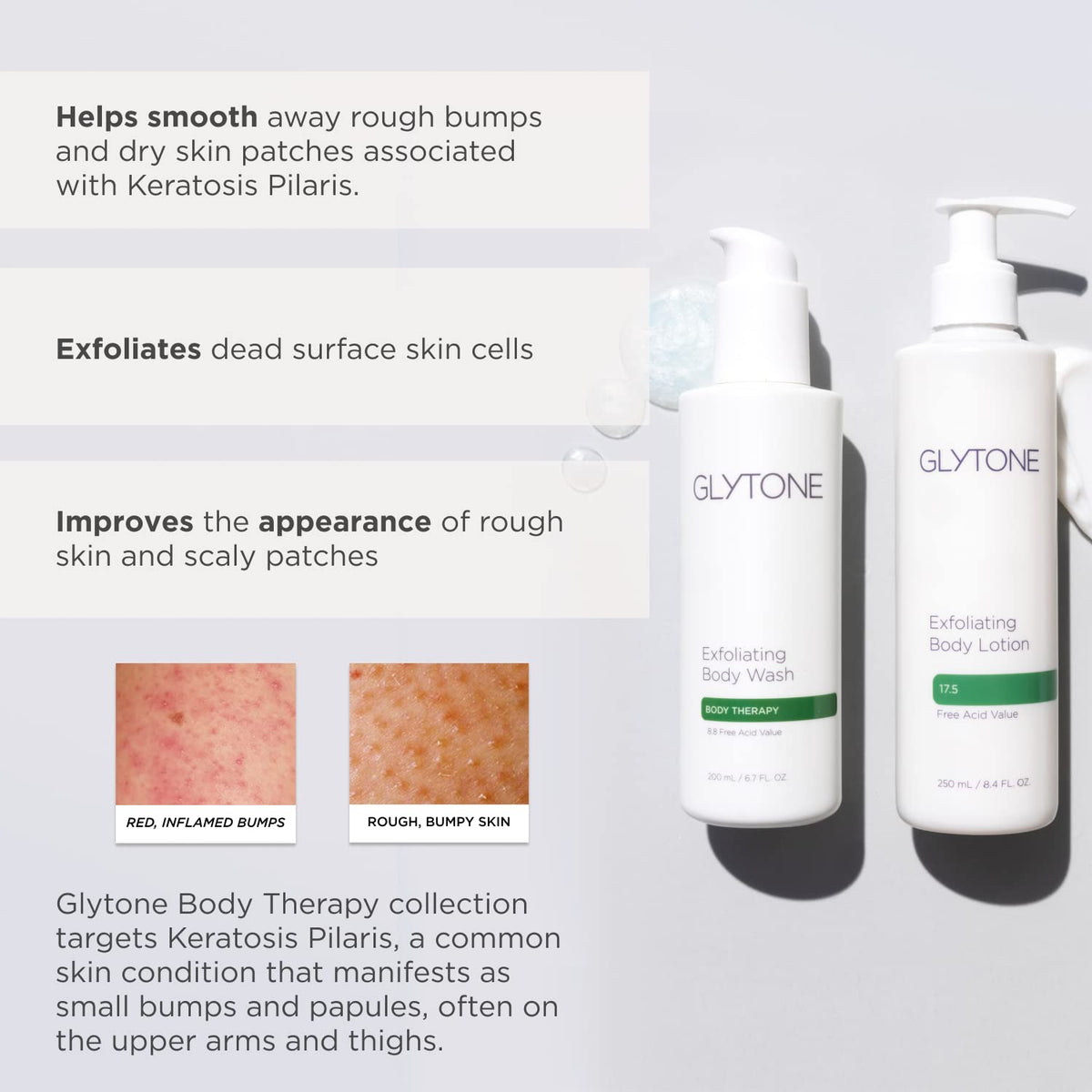 GLYTONE bottle next to a hand for scale, shows travel-friendly 2 fl oz size
