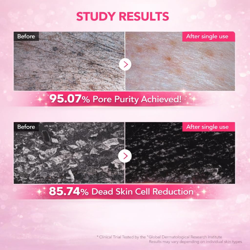 GOERTI ceramide and hyaluronic detail showing moisture support and balance