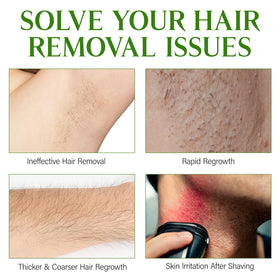 GOGIFTGO smooth skin lifestyle image showing aftercare results and softer skin benefit