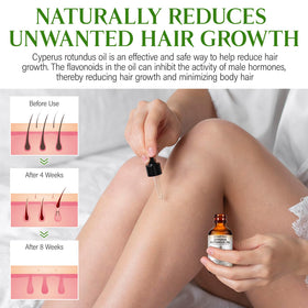 GOGIFTGO bottle closeup with label highlighting natural cyperus seed oil benefit