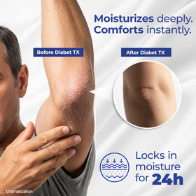 Goicoechea applying lotion to hands to soothe dryness and improve skin comfort