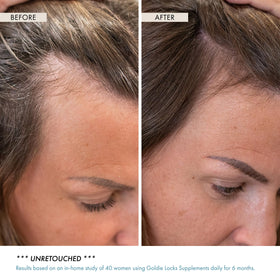 Goldie Locks infographic of five collagen types for structural support