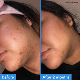 Good Molecules dispensing a drop of serum from pump demonstrating controlled application