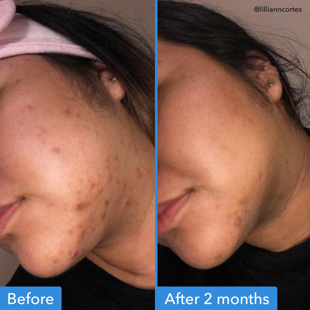 Good Molecules serum texture closeup showing lightweight, fast-absorbing formula