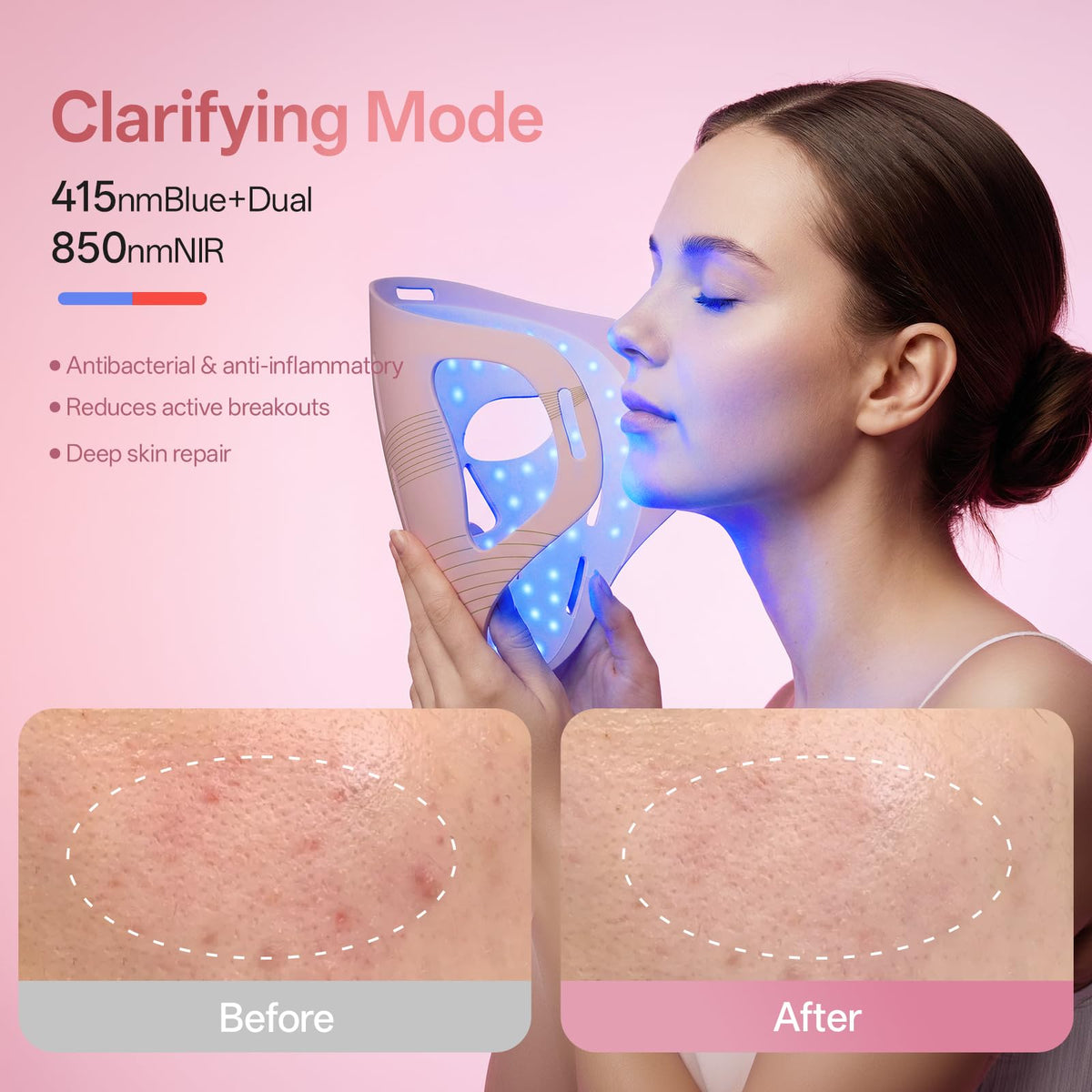Graart silicone texture detail demonstrating soft comfort and skin-friendly feel