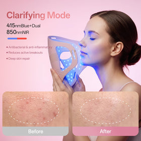 Graart silicone texture detail demonstrating soft comfort and skin-friendly feel