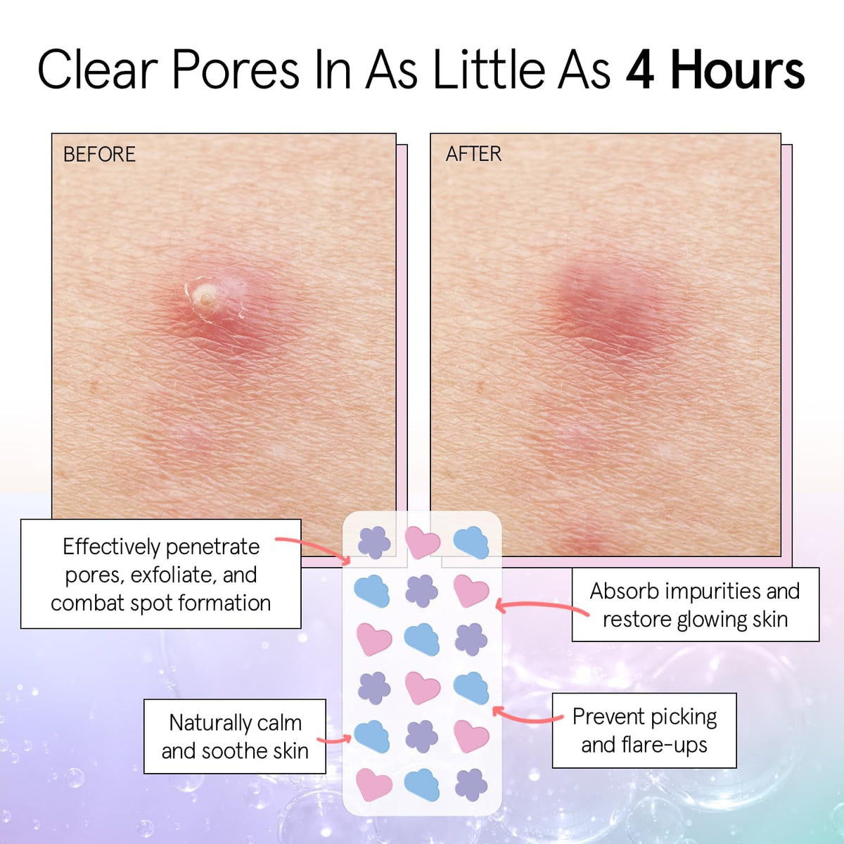 grace & stella heart-shaped patch applied on cheek protecting blemish and reducing picking